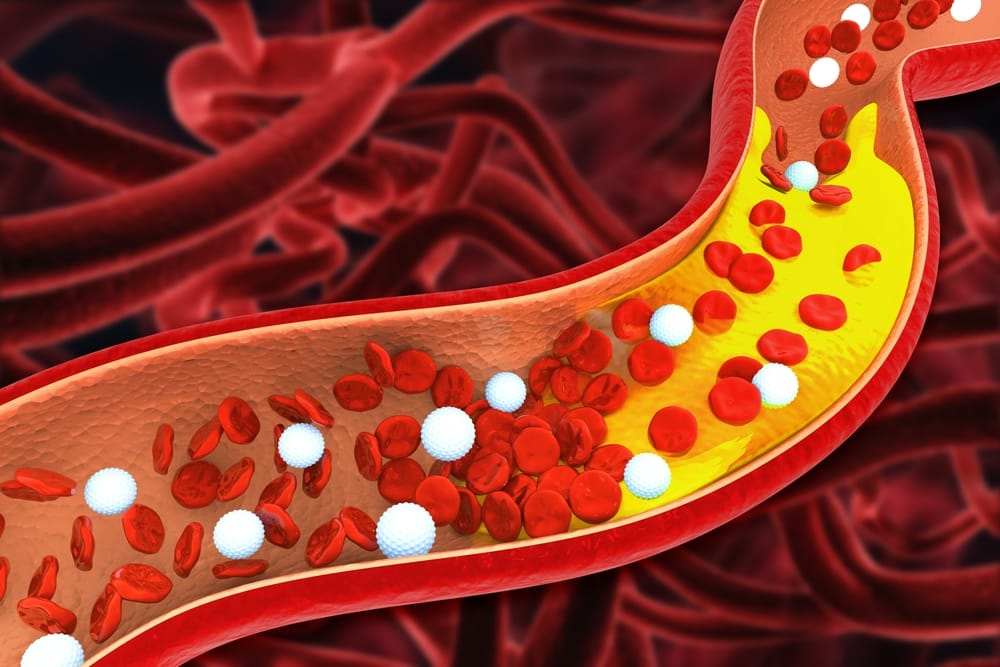 Cholesterol